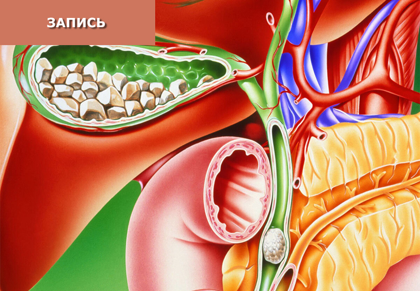 Лечение желчнокаменной болезни методами китайской медицины